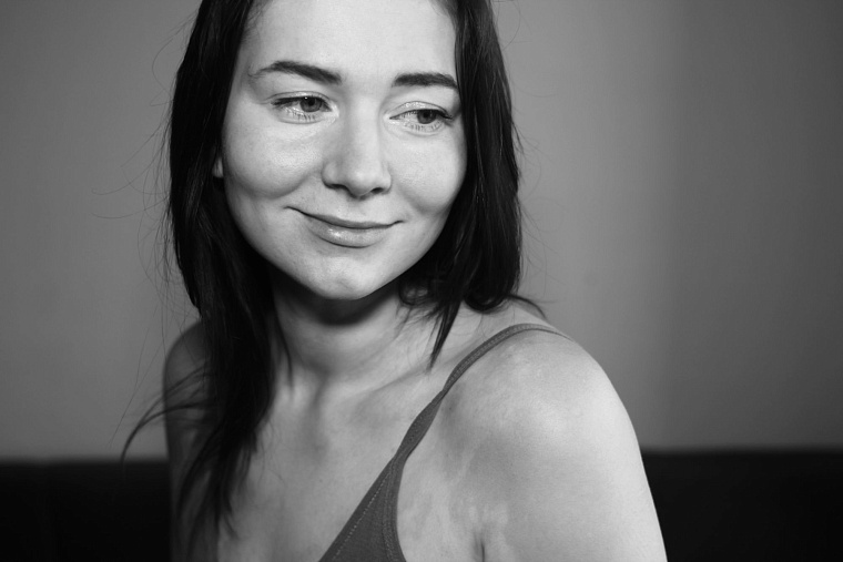 Несладкая жизнь: история тюменки, живущей с диабетом