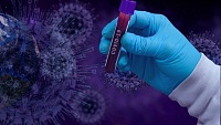В Тюменской области за минувшие сутки еще 68 человек заболели коронавирусом