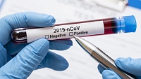 За неделю в регионе провели почти 35 тыс. тестов на коронавирус