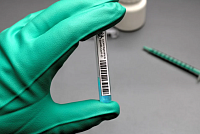 Государству предлагают оплачивать тесты на коронавирус, сделанные в частных клиниках