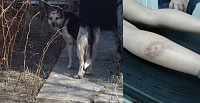 Бродячая собака в Тюмени покусала ребенка: подробности резонансного происшествия