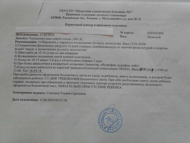 Бродячая собака в Тюмени покусала ребенка: подробности резонансного происшествия