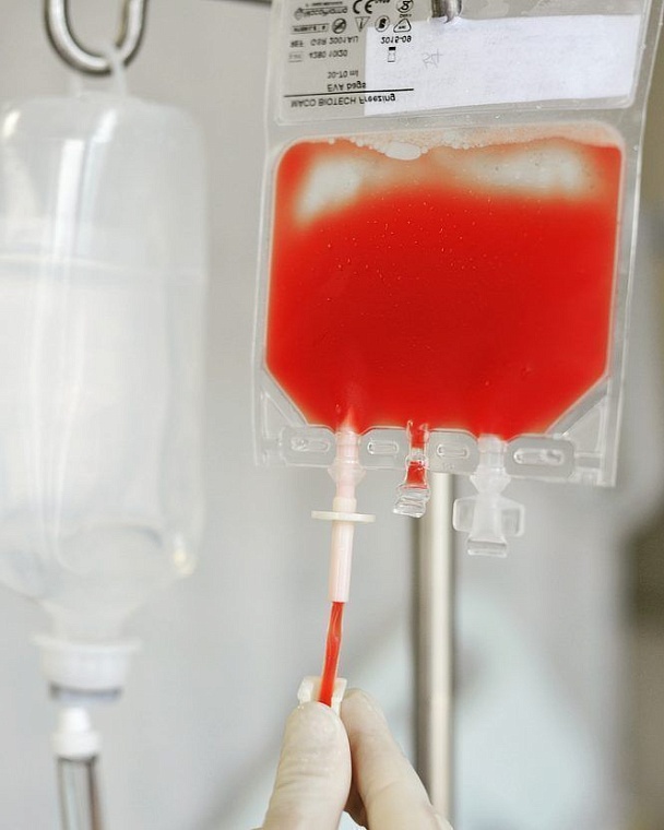 Все зависит от настроя: тюменки рассказали, как им пересадили костный мозг