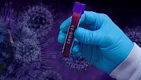 В Тюменской области за минувшие сутки выявили 85 новых заболевших коронавирусом