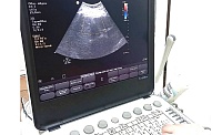 В Боровскую участковую больницу поставили два аппарата УЗИ и маммограф