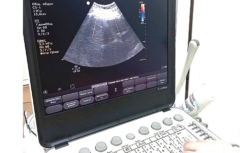 В Боровскую участковую больницу поставили два аппарата УЗИ и маммограф