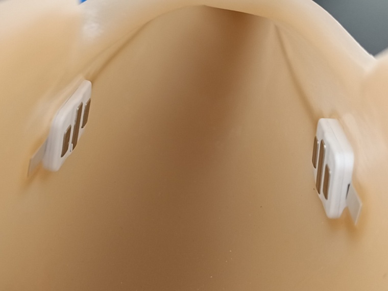 Тюменским участникам СВО предоставляют протезы с микропроцессорным управлением