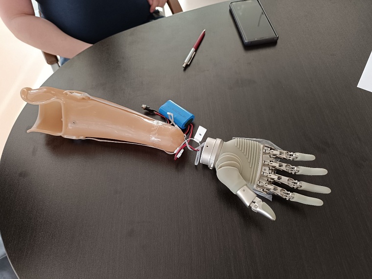 Тюменским участникам СВО предоставляют протезы с микропроцессорным управлением