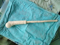В Тюмени в 3D напечатали самый крупный протез для замены бедренной кости