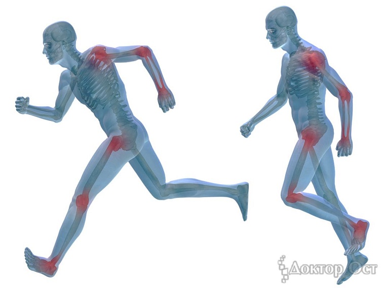 Берегите позвоночник и суставы: как понять, что пора бежать к врачу и можно ли избежать операции