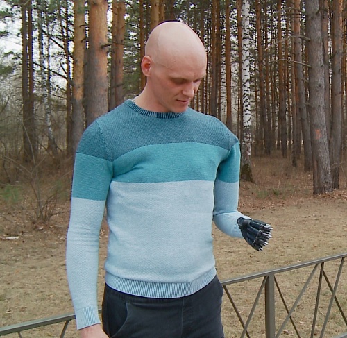 Тюменцу с протезом за 8 миллионов отказывают в его ремонте