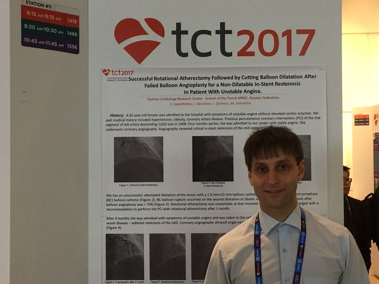 Хирурги Тюменского кардиоцентра представили Россию на крупнейшем конгрессе в США