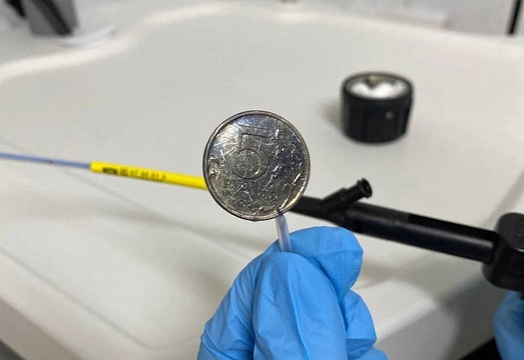 В ишимской больнице рассказали, какие монеты глотают дети