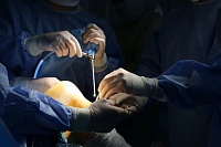 Тюменские врачи провели успешную операцию 15-летней пациентке с невыносимыми болями и патологией колена