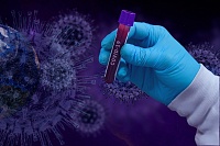 В Тюменской области выявлен 141 заразившийся коронавирусом