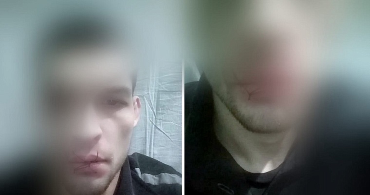 В тюменской ИК-2 заключенный зашил себе рот