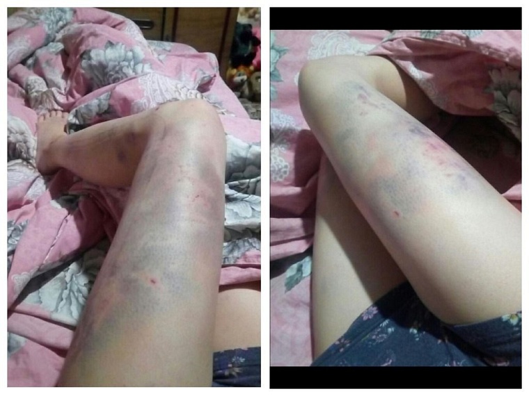 Эти фотографии Д. присылала своим подругам после очередного избиения