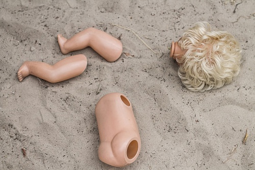 В Тюмени стаффорд вцепился в лицо двухлетнему ребенку