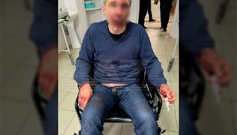 Житель Нальчика избил учителя, поссорившегося с его племянником