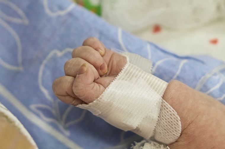 Тюменские врачи выходили крошечную новорожденную весом менее 500 граммов