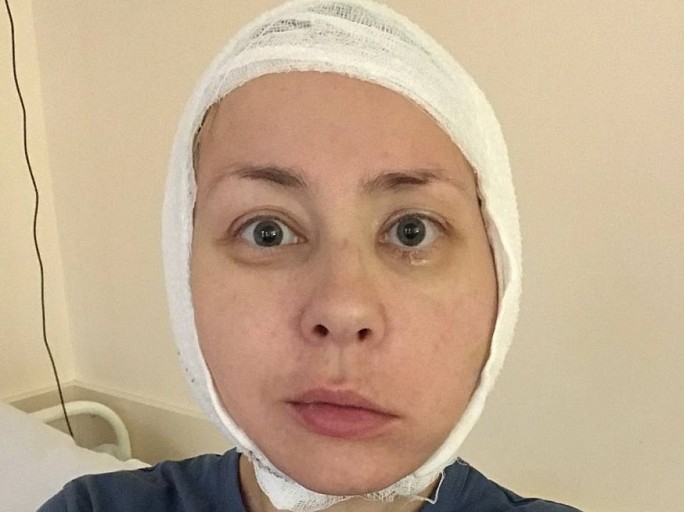 «Мое лицо стоит миллион»: история, изменившая жизнь одной женщины