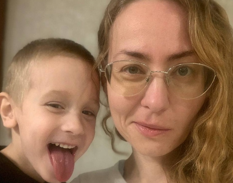 «Мое лицо стоит миллион»: история, изменившая жизнь одной женщины