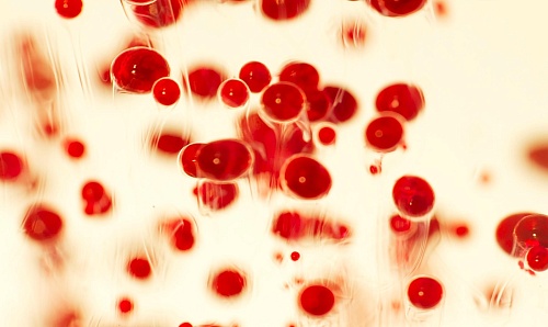 В Тюмени пациентам переливают их собственную кровь благодаря "Спасателю клеток"