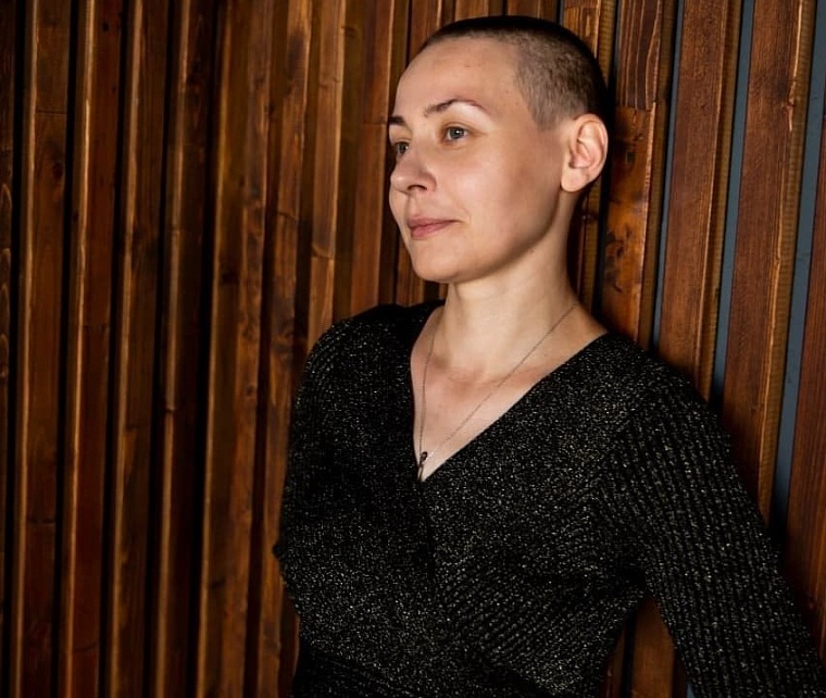 «Мое лицо стоит миллион»: история, изменившая жизнь одной женщины